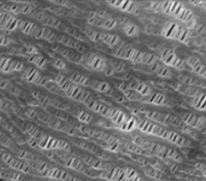 Surface SEM image of Battery Diaphragm