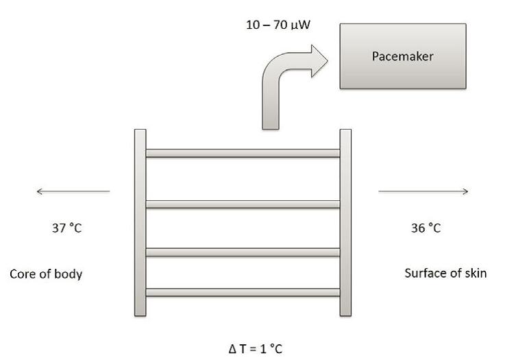 Figure 4: block diagram of pacemaker using thermal energy acquisition technology